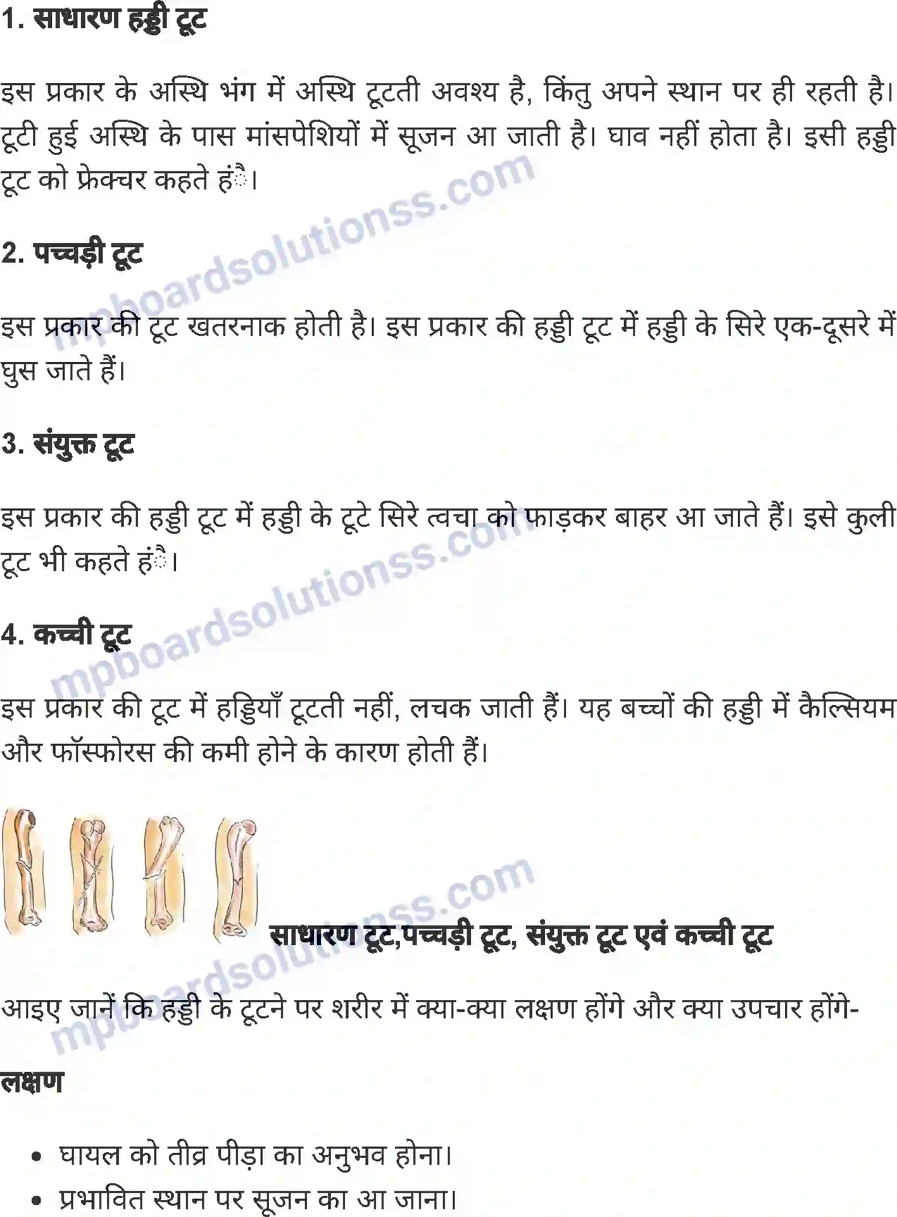 MP Board Book for Class 8 Home Science प्राथमिक उपचार Image 9
